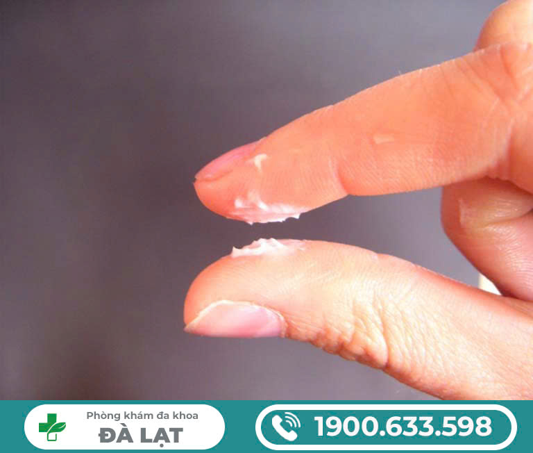 KHÍ HƯ DẠNG THẠCH, DẠNG BỘT? DẤU HIỆU VIÊM NHIỄM NGUY HIỂM?